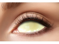 sclera_2